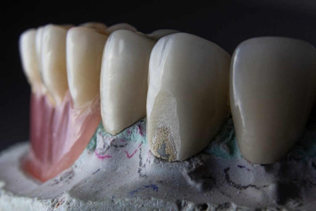 Photo Remboursement orthodontie adulte