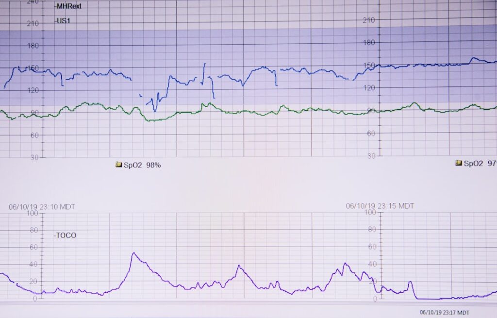 Photo data quality testing