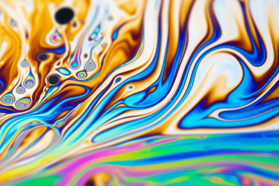 ALM and liquidity optimization